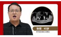 全口缺牙怎么办？登特口